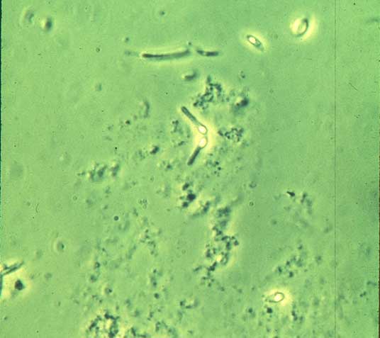 肉毒梭状芽胞杆菌