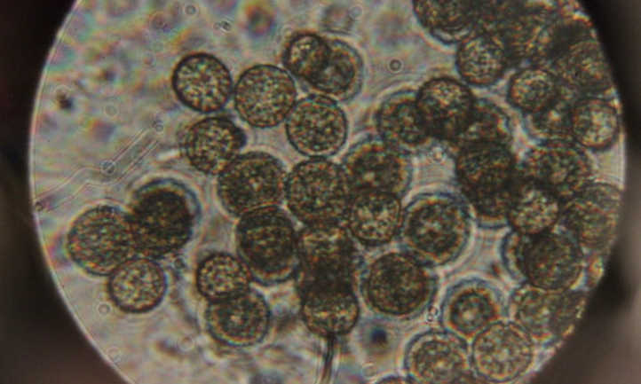 Ustilago maydis在显微镜下